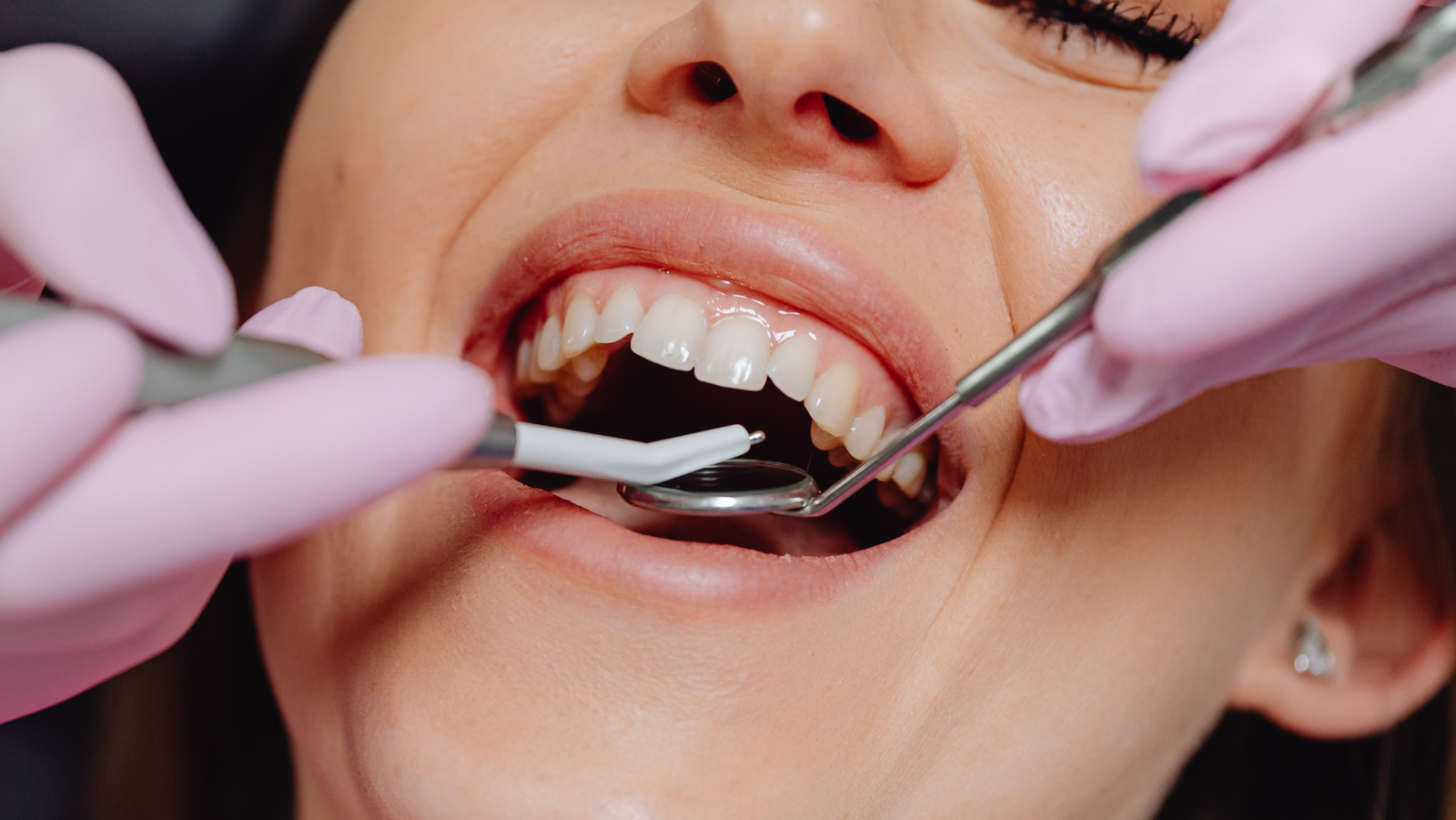 modern equipment used in dental treatments for all ages