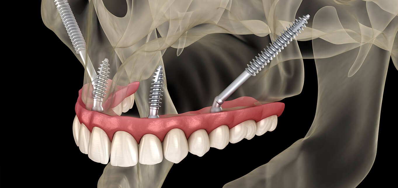 modern equipment used in dental treatments for all ages