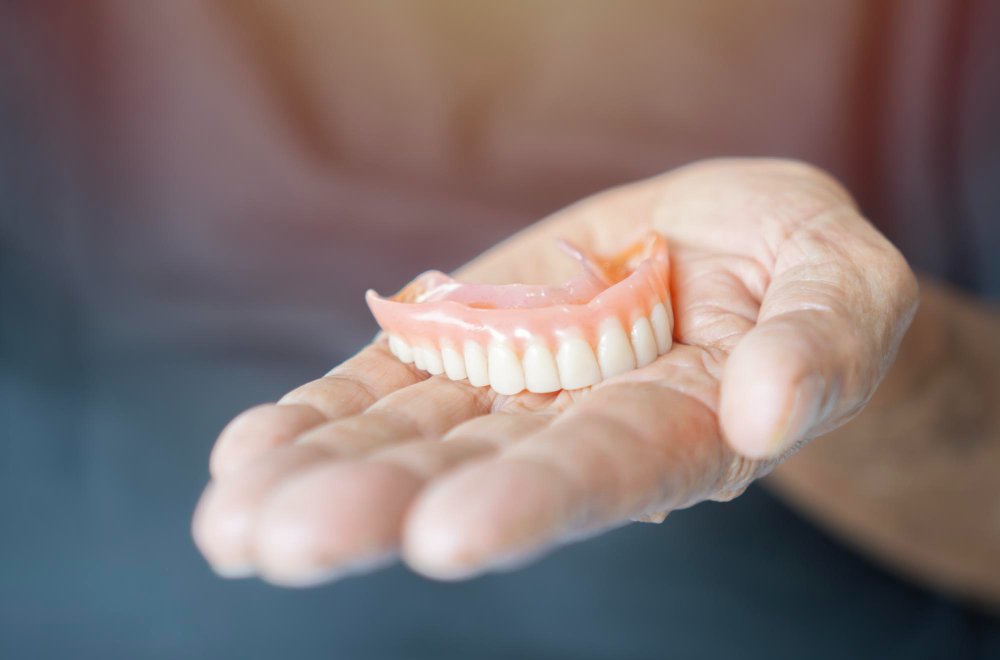 Dentures Lifespan: How Long They Last and What to Expect